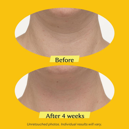 StriVectin TL Advanced Crema para Cuello 7ml 0.25oz